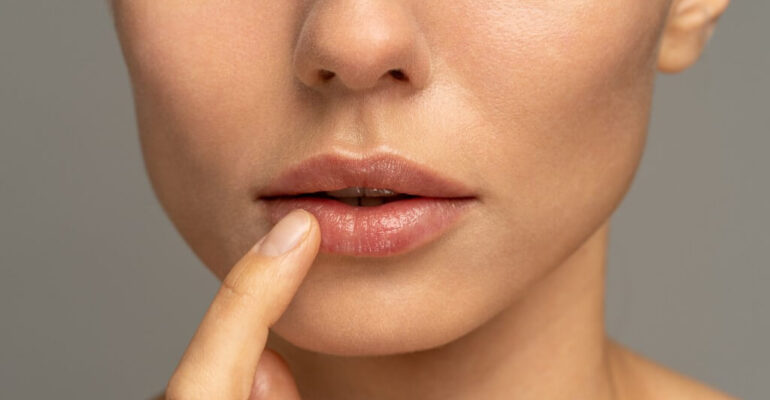 Chapped lips: 5 natural remedies to get rid of chapped lips