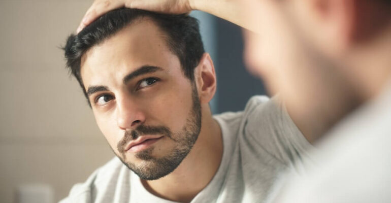 Hair loss: Causes of hair fall in men