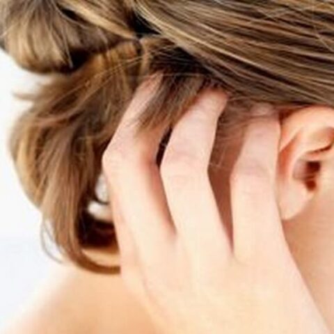 Scalp psoriasis: Effective home remedies for relief